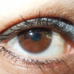 Και όμως η βιταμίνη C μειώνει τον κίνδυνο εξέλιξης καταρράκτη