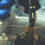 Υγεία: Για πρώτη φορά ένα αυτόνομο ρομπότ έκανε εγχείριση εντέρου καλύτερα και από έμπειρους χειρουργούς