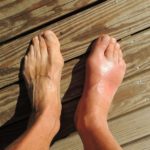 Πρωτοποριακή αντιμετώπιση της ρευματοειδούς αρθρίτιδας με τεχνητή ενεργοποίηση του πνευμονογαστρικού νεύρου