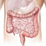 Ελπίδες για καλά και πολλά χρόνια ζωής σε ασθενείς με μεταστατικό καρκίνο του παχέως εντέρου