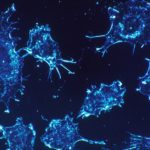 Ανοσο-ογκολογία: Το νέο όπλο για την αντιμετώπιση του καρκίνου