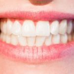 Επικίνδυνη για την υγεία η λεύκανση δοντιών εκτός οδοντιατρείου, επισημαίνει ο Οδοντιατρικός Σύλλογος Αττικής