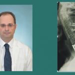 Αγκυλοποιητική σπονδυλίτιδα – Μια ύπουλη πάθηση που μπορεί να αποβεί μοιραία