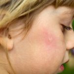 Μάθετε ποια είναι τα Φυσικά εντομοαπωθητικα που έχουμε σπίτι μας – Γράφει η Μαρία Αλιμπέρτη Κατσάνη