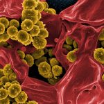 Δέκα πράγματα που πρέπει να ξέρουμε για την ανθεκτικότητα των βακτηρίων που φτάνουν από το αγρόκτημα σε εμάς