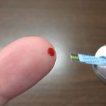 Θεσσαλονίκη: Πενήντα χιλιάδες διαβητικοί στη χώρα μας έχουν στα πόδια έλκη που αν δεν αντιμετωπιστούν εγκαίρως μπορεί να οδηγήσουν σε ακρωτηριασμό