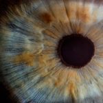 Ο καταρράκτης αφαιρείται πλέον πριν … ωριμάσει