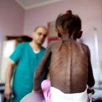 ΕΙΔΗΣΕΙΣ ΣΕ ΒΙΝΤΕΟ: 35 ΜΚΟ: Σταματήστε το έγκλημα στην Υεμένη – Εικόνες γροθιά στο στομάχι