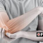 Διατροφή για γερά οστά και κόκκαλα: 8 διατροφικές συμβουλές