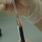 Θεσσαλονίκη: Δωρεάν διάγνωση 500 γενετικών παθήσεων με μια σταγόνα αίμα σε 1000 βρέφη στην Ελλάδα στο πλαίσιο της μελέτης «FirstSteps»