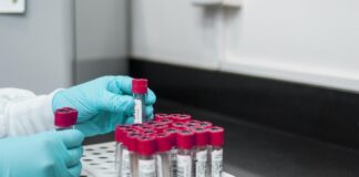 Υγεία: Εξέταση αίματος μπορεί να εντοπίσει σημάδια του Αλτσχάιμερ πολύ πριν από την εμφάνιση των συμπτωμάτων